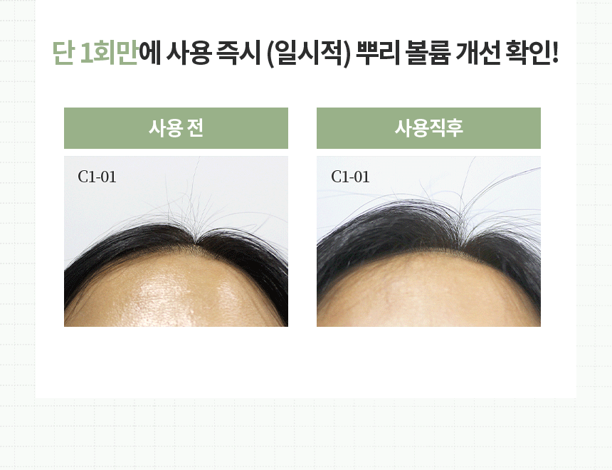 stemcell_14